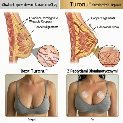 ✨Turonu® 🍑Zaawansowanynano-mikroigłowy plaster do ukierunkowanego powiększania biustu
