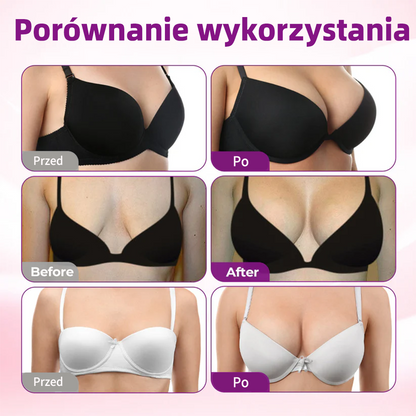 ✨Turonu® 🍑Zaawansowanynano-mikroigłowy plaster do ukierunkowanego powiększania biustu